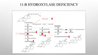 11-Β HYDROXYLASE DEFICIENCY
11- Hydroxylase
CRH, ACTH
 