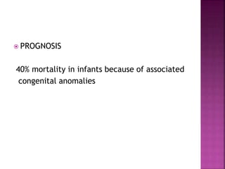  PROGNOSIS
40% mortality in infants because of associated
congenital anomalies
 