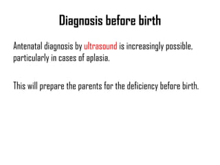 Congenital anamolies upper limb - Dr.KK