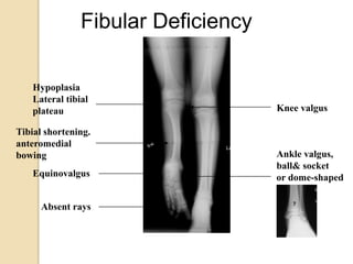 Congenital and developmental anomalies.2560