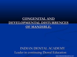 CONGENITAL ANDCONGENITAL AND
DEVELOPMENTAL DISTURBENCESDEVELOPMENTAL DISTURBENCES
OF MANDIBLE.OF MANDIBLE.
INDIAN DENTAL ACADEMYINDIAN DENTAL ACADEMY
Leader in continuing Dental EducationLeader in continuing Dental Education
www.indiandentalacademy.com
 