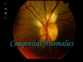 Congenital Anomalies
 