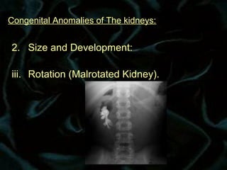 Renal Rotation Radiology Congenital anomalies | PPT