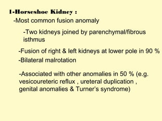 1-Horseshoe Kidney :
-Most common fusion anomaly
-Two kidneys joined by parenchymal/fibrous
isthmus
-Fusion of right & left kidneys at lower pole in 90 %
-Bilateral malrotation
-Associated with other anomalies in 50 % (e.g.
vesicoureteric reflux , ureteral duplication ,
genital anomalies & Turner’s syndrome)
 
