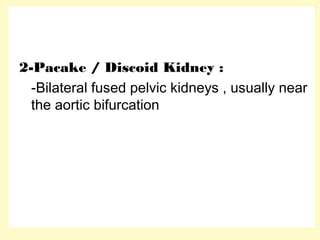 2-Pacake / Discoid Kidney :
-Bilateral fused pelvic kidneys , usually near
the aortic bifurcation
 