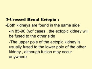 3-Crossed Renal Ectopia :
-Both kidneys are found in the same side
-In 85-90 %of cases , the ectopic kidney will
be fused to the other side
-The upper pole of the ectopic kidney is
usually fused to the lower pole of the other
kidney , although fusion may occur
anywhere
 