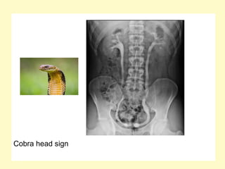 Cobra head sign
 