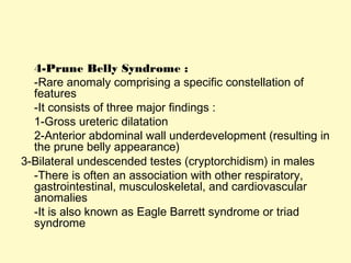 4-Prune Belly Syndrome :
-Rare anomaly comprising a specific constellation of
features
-It consists of three major findings :
1-Gross ureteric dilatation
2-Anterior abdominal wall underdevelopment (resulting in
the prune belly appearance)
3-Bilateral undescended testes (cryptorchidism) in males
-There is often an association with other respiratory,
gastrointestinal, musculoskeletal, and cardiovascular
anomalies
-It is also known as Eagle Barrett syndrome or triad
syndrome
 