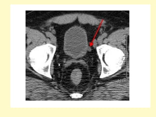 Congenital anomalies radiology