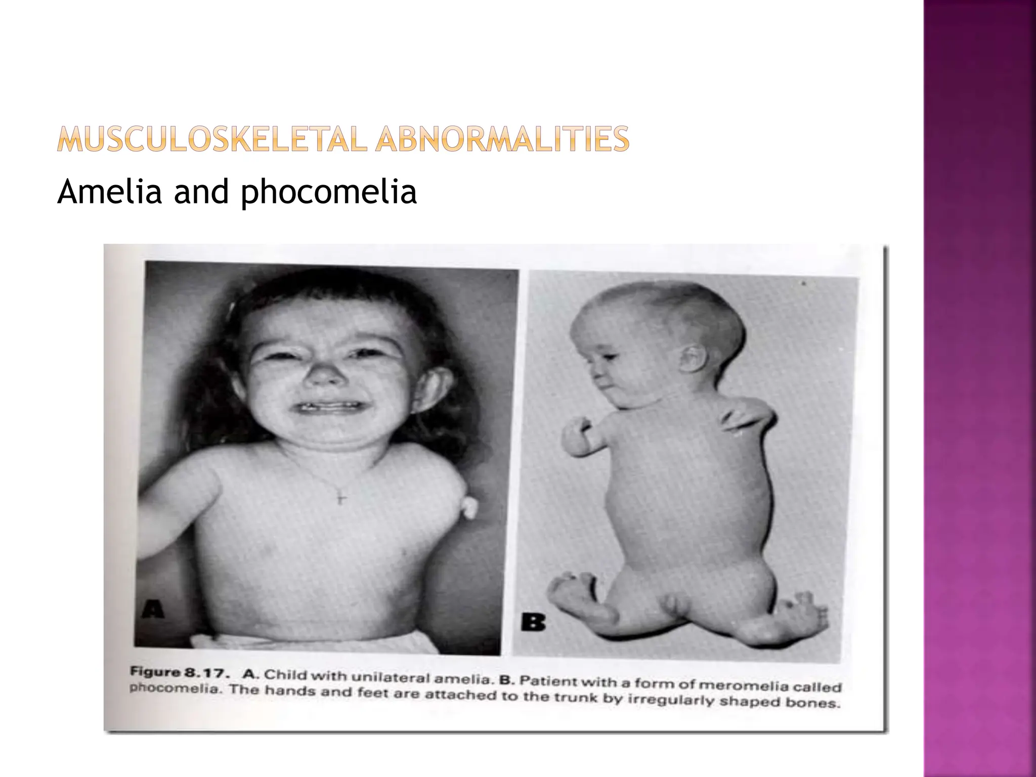 Congenitalanomalies 160922061120 hahaha pdf congenitalanomalies-160922061120-hahaha-pdf