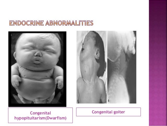 CONGENITAL HYPOPITUITARISM PDF CONGENITAL HYPOPITUITARISM PDF
