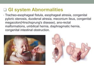  Gl system Abnormalities
• Tracheo-esophageal fistula, esophageal atresia, congenital
pyloric stenosis, duodenal atresia, meconium ileus, congenital
megacolon(Hirschsprung's disease), ano-rectal
malformations, umbilical hernia, diaphragmatic hernia,
congenital intestinal obstruction.
 