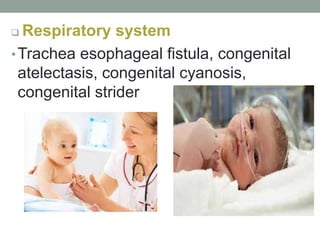  Respiratory system
•Trachea esophageal fistula, congenital
atelectasis, congenital cyanosis,
congenital strider
 