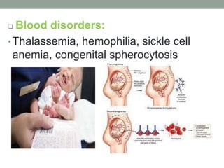  Blood disorders:
•Thalassemia, hemophilia, sickle cell
anemia, congenital spherocytosis
 
