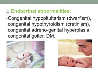  Endocrinal abnormalities:
•Congenital hypopituitarism (dwarfism),
congenital hypothyroidism (cretinism),
congenital adreno-genital hyperplasia,
congenital goiter, DM.
 