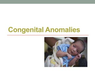 Congenital Anomalies
 