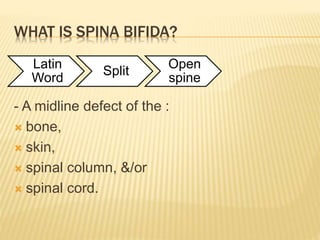 Spinal Defet Congenital anomalies/Neural tube defects/ birth defects | PPTX