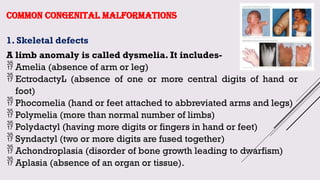 Comprehensive Overview of Congenital Anomalies: Causes, Diagnosis, and ...