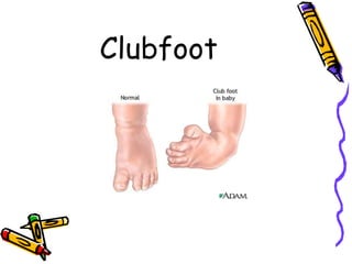 Congenital anomalies1