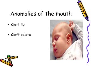 Congenital anomalies1