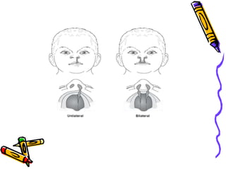 Congenital anomalies1