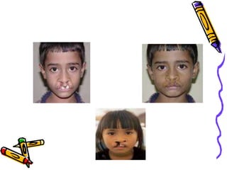 Congenital anomalies1