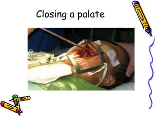 Congenital anomalies1