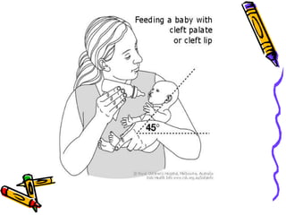 Congenital anomalies1