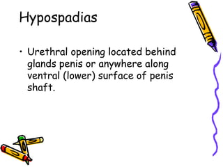 Congenital anomalies1