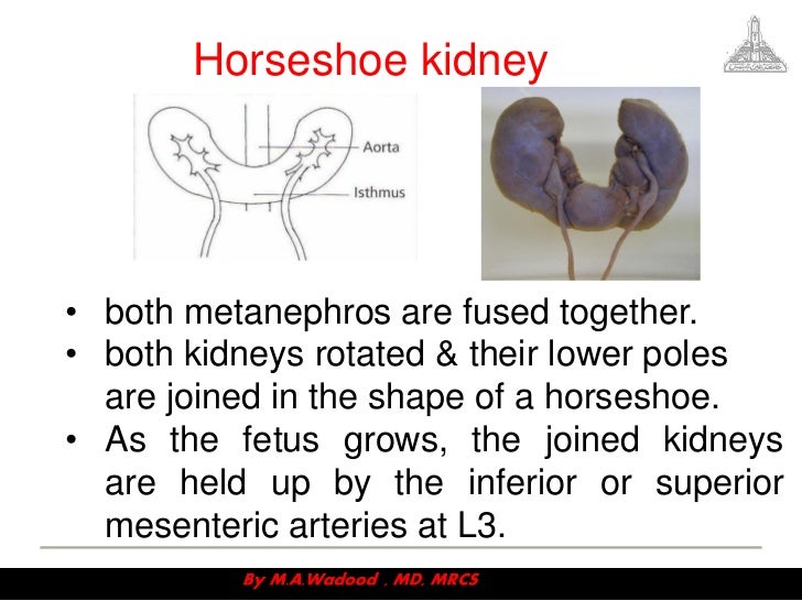 Congenital anomalies ppt
