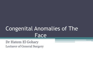 Congenital Anomalies of The
Face
Dr Hatem El Gohary
Lecturer of General Surgery
 