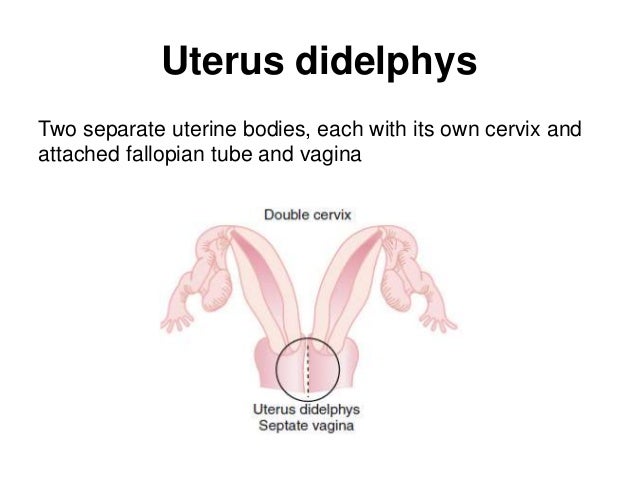 What are some abnormalities of the uterus?