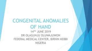 Congenital anomalies of hand | PPTX