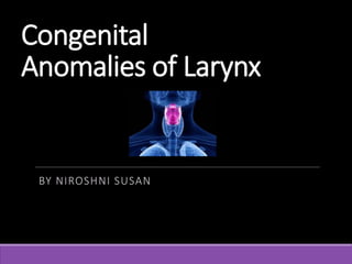 Congenital
Anomalies of Larynx
BY NIROSHNI SUSAN
 