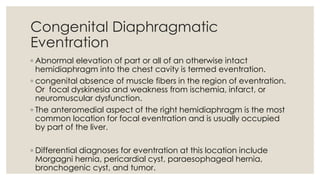Eventrated Congenital anomalies of respiratory system A Radiological approach | PDF
