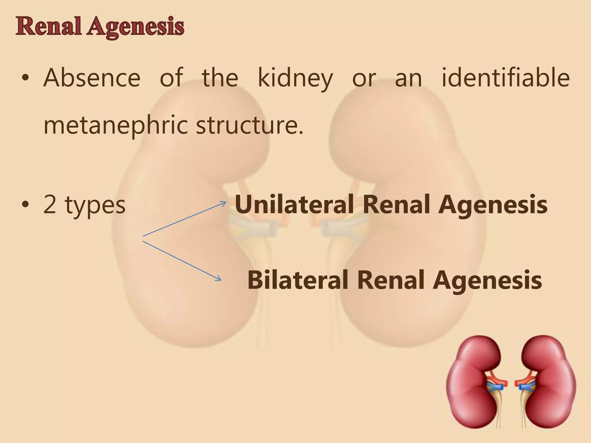 Congenital anomalies of the kidney and urinary tract | PPTX