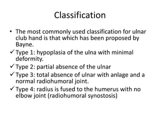 Congenital anomalies of upper limb | PPTX