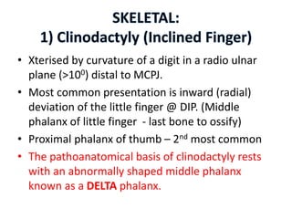 Congenital anomalies of upper limb | PPTX