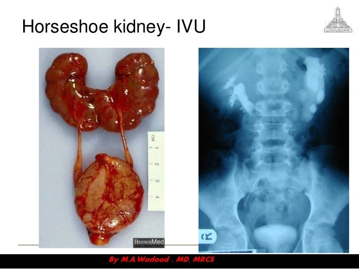 Congenital anomalies videosession v3