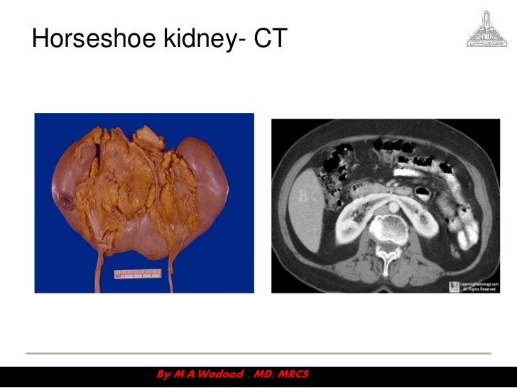 Congenital anomalies videosession v3
