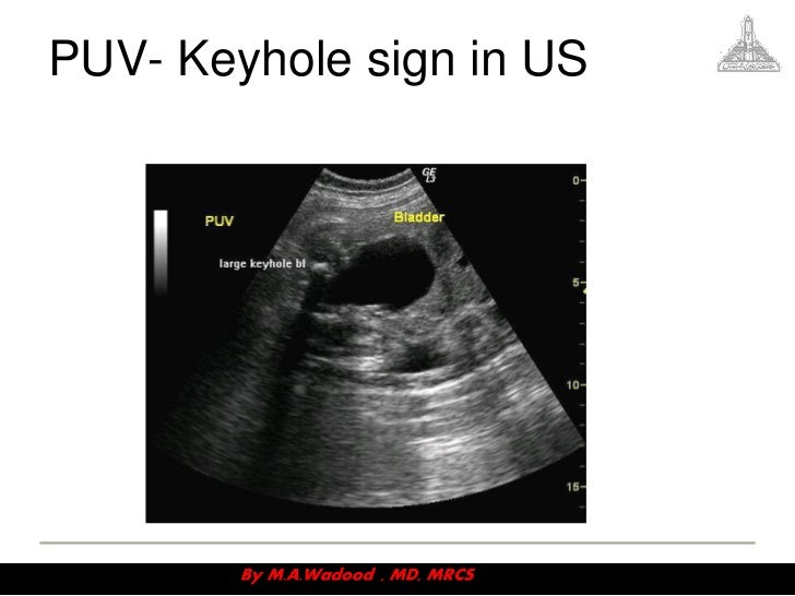 Congenital anomalies videosession v3