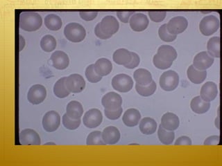 Congenital bleeding disorders | PPT