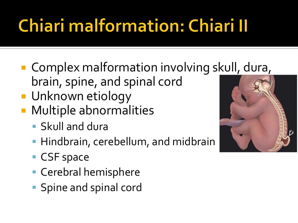 Congenital brain anomalies