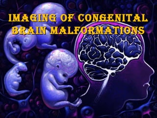 ImagIng of CongenItalImagIng of CongenItal
BraIn malformatIonsBraIn malformatIons
 