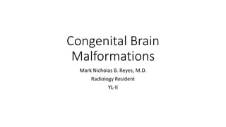 Congenital Brain
Malformations
Mark Nicholas B. Reyes, M.D.
Radiology Resident
YL-II
 