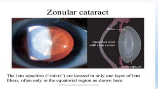 Pediatric (congenital, developmental) cataract and management ...