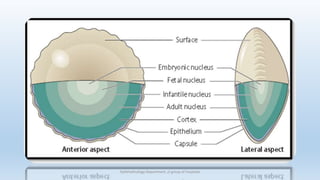 Pediatric (congenital, developmental) cataract and management ...