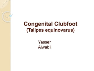Congenital Clubfoot Congenital Clubfoot