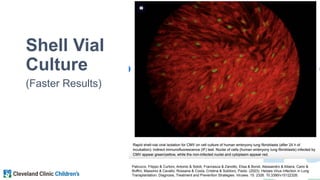 Congenital Cytomegalovirus Infection in Neonates | PPTX