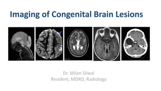 Imaging of Congenital Brain Lesions
Dr. Milan Silwal
Resident, MDRD, Radiology
 